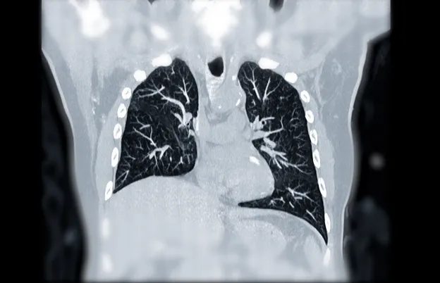 

            Pulmonary Emergencies in the ER
      