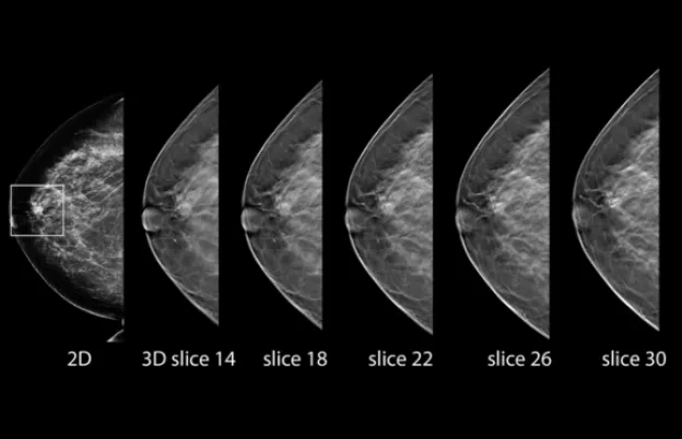 Hands-on Digital Breast Tomosynthesis Training Workshop